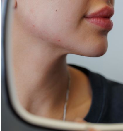 3-Ästhetische Behandlung 420 X 450