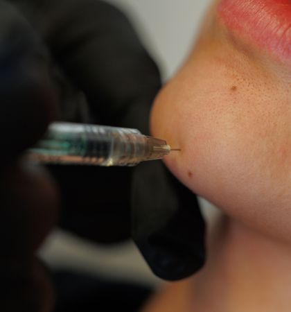 4-Ästhetische Behandlung 420 X 450