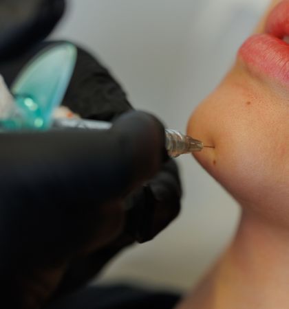 5-Ästhetische Behandlung 420 X 450