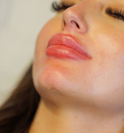 9-Ästhetische Behandlung 420 X 450